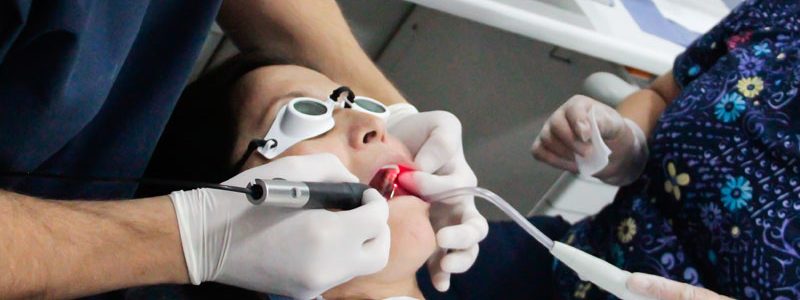 Laser dental